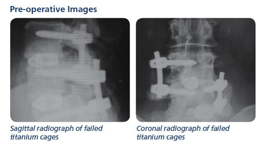 Preop_images